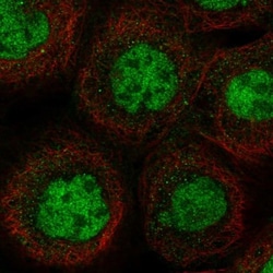 MSL1 Antibody, Novus Biologicals:Antibodies:Primary Antibodies